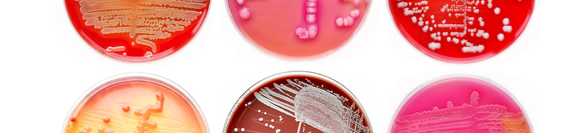 Microbial Risk Management During Cleanroom Operations